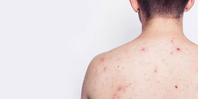 Mách bạn cách thải độc gan tại nhà đơn giản