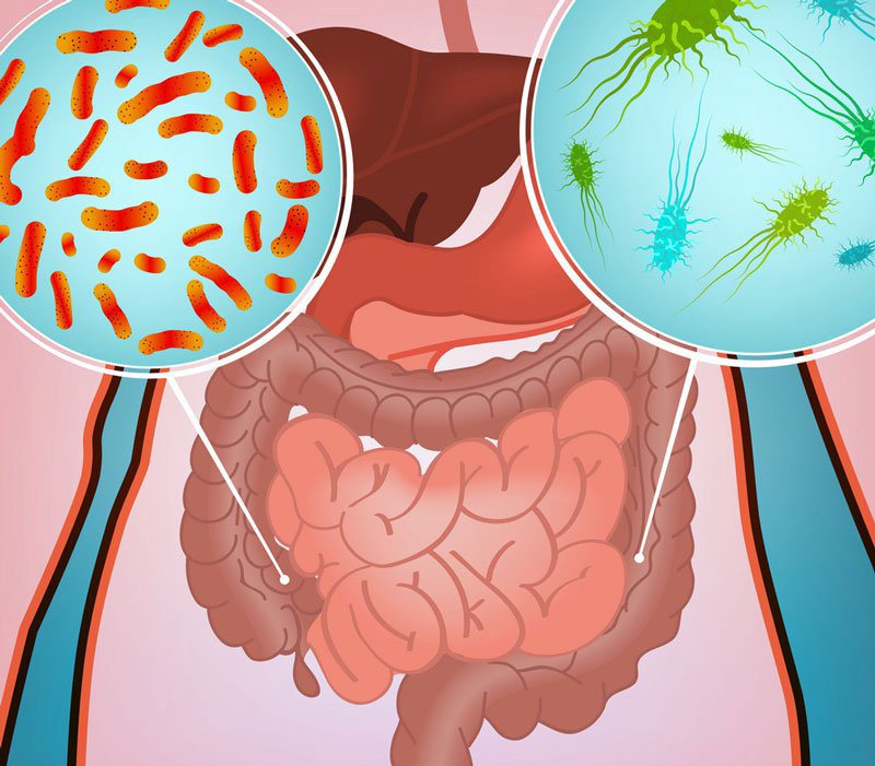 Nhiễm khuẩn đường ruột uống thuốc gì? Nguyên nhân và đối tượng dễ mắc 